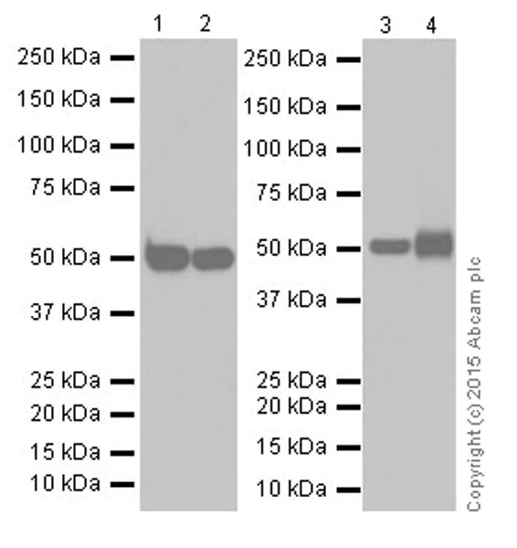 Western blot - Anti-Alanine Transaminase antibody [EPR19616] (AB202083)
