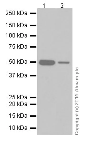 Western blot - Anti-Alanine Transaminase antibody [EPR19616] (AB202083)