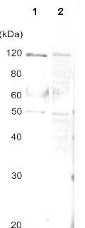 Western blot - Anti-AlaRS antibody (AB139993)