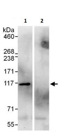 Immunoprecipitation - Anti-AlaRS antibody (AB226259)