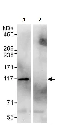 Immunoprecipitation - Anti-AlaRS antibody (AB226259)
