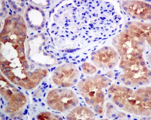 Immunohistochemistry (Formalin/PFA-fixed paraffin-embedded sections) - Anti-AlaRS antibody [EPR11037(B)] (AB155275)