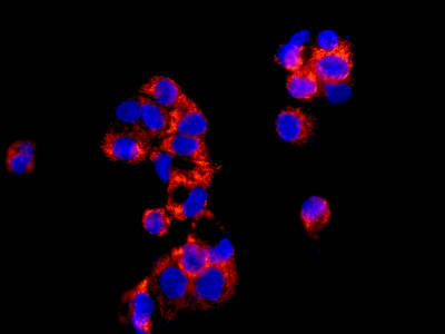 Immunocytochemistry/ Immunofluorescence - Anti-Alas1 antibody [EPR10247] - Mitochondrial Marker (ab154860), expandable thumbnail