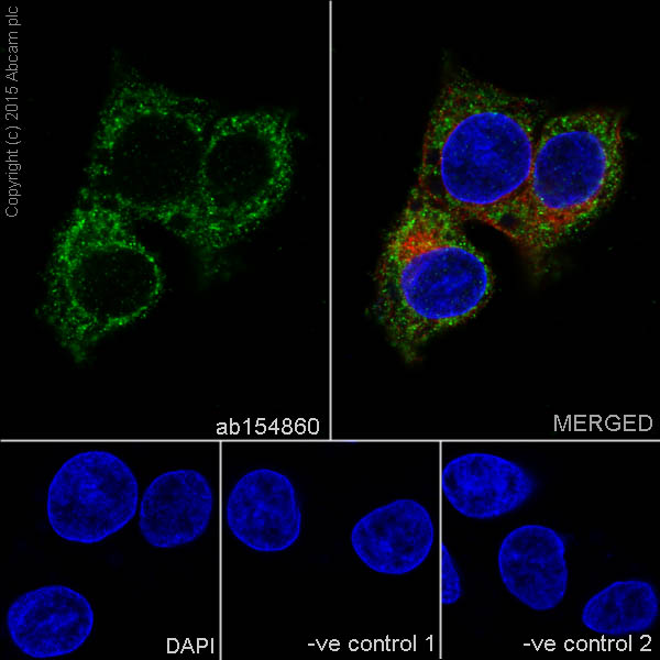 Immunocytochemistry/ Immunofluorescence - Anti-Alas1 antibody [EPR10247] - Mitochondrial Marker (AB154860), expandable thumbnail