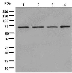 Western blot - Anti-Alas1 antibody [EPR10247] - Mitochondrial Marker (AB154860)