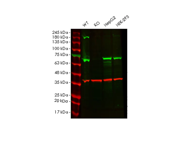 Western blot - Anti-Alas1 antibody [EPR10247] - Mitochondrial Marker (AB154860)