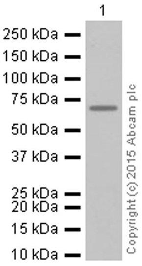 Western blot - Anti-Alas1 antibody [EPR10247] - Mitochondrial Marker (AB154860), expandable thumbnail