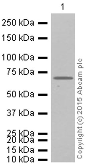 Western blot - Anti-Alas1 antibody [EPR10247] - Mitochondrial Marker (AB154860), expandable thumbnail