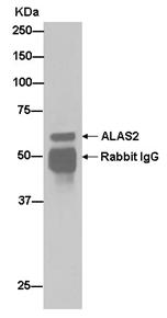 Immunoprecipitation - Anti-ALAS2/ASB antibody [EPR15112(B)] - C-terminal (AB184964), expandable thumbnail