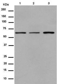Western blot - Anti-ALAS2/ASB antibody [EPR15112(B)] - C-terminal (AB184964), expandable thumbnail