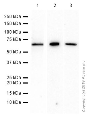 Western blot - Anti-ALAS2/ASB antibody [EPR15112(B)] - C-terminal (AB184964), expandable thumbnail