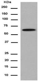 Western blot - Anti-ALAS2/ASB antibody [EPR15112(B)] - C-terminal (AB184964), expandable thumbnail