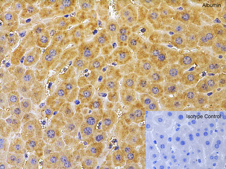 Immunohistochemistry (Formalin/PFA-fixed paraffin-embedded sections) - Anti-Albumin antibody (AB106582)