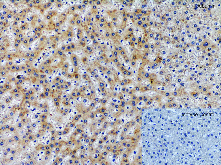 Immunohistochemistry (Formalin/PFA-fixed paraffin-embedded sections) - Anti-Albumin antibody (AB106582)