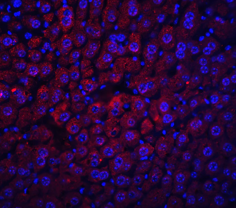 Immunohistochemistry (Formalin/PFA-fixed paraffin-embedded sections) - Anti-Albumin antibody (AB106582)