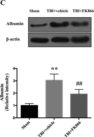 Western blot - Anti-Albumin antibody (AB106582)