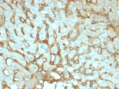 Immunohistochemistry (Formalin/PFA-fixed paraffin-embedded sections) - Anti-Albumin antibody [ALB/2144] - BSA and Azide free (AB237838)