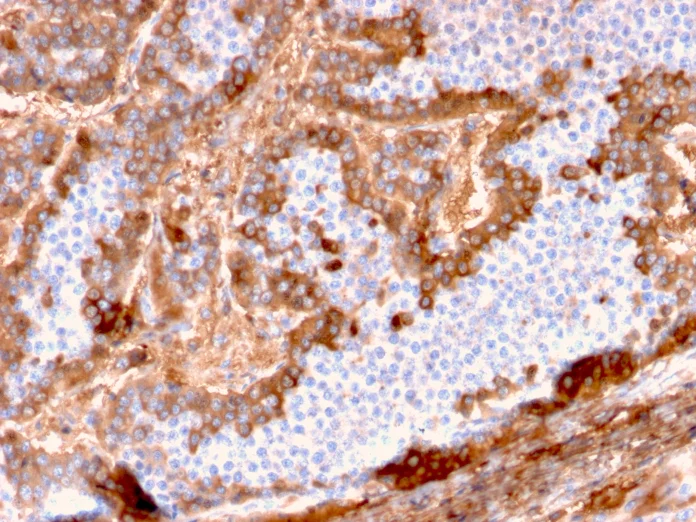 Immunohistochemistry (Formalin/PFA-fixed paraffin-embedded sections) - Anti-Albumin antibody [ALB/2144] - BSA and Azide free (AB237838)