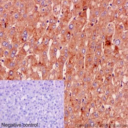 Immunohistochemistry (Formalin/PFA-fixed paraffin-embedded sections) - Anti-Albumin antibody [EPR12774] (AB192603)