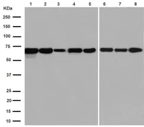 Western blot - Anti-Albumin antibody [EPR12774] (AB192603)