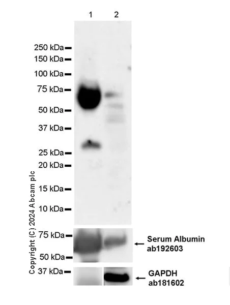 Western blot - Anti-Albumin antibody [EPR12774] (AB192603)