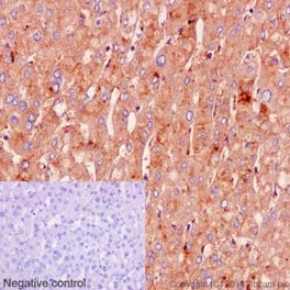 Immunohistochemistry (Formalin/PFA-fixed paraffin-embedded sections) - Anti-Albumin antibody [EPR12774] - BSA and Azide free (AB240330)
