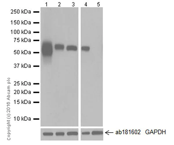 Western blot - Anti-Albumin antibody [EPR20195] (AB207327)