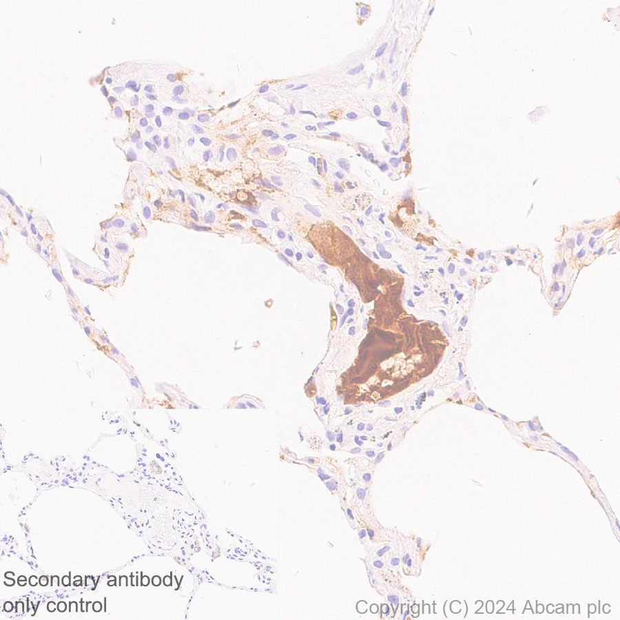 Immunohistochemistry (Formalin/PFA-fixed paraffin-embedded sections) - Anti-Albumin antibody [EPR23014-11] - BSA and Azide free (Capture) (AB277249)