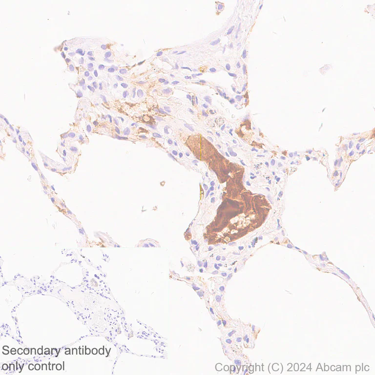 Immunohistochemistry (Formalin/PFA-fixed paraffin-embedded sections) - Anti-Albumin antibody [EPR23014-11] - BSA and Azide free (Capture) (AB277249)