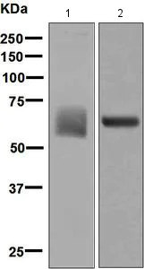 Western blot - Anti-Albumin antibody [EPSISR1] (AB137885)