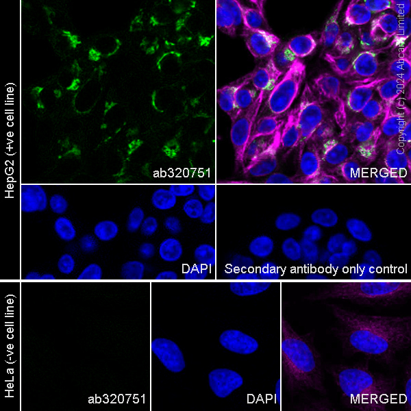 Immunocytochemistry/ Immunofluorescence - Anti-Albumin antibody [RM1208] (AB320751), expandable thumbnail