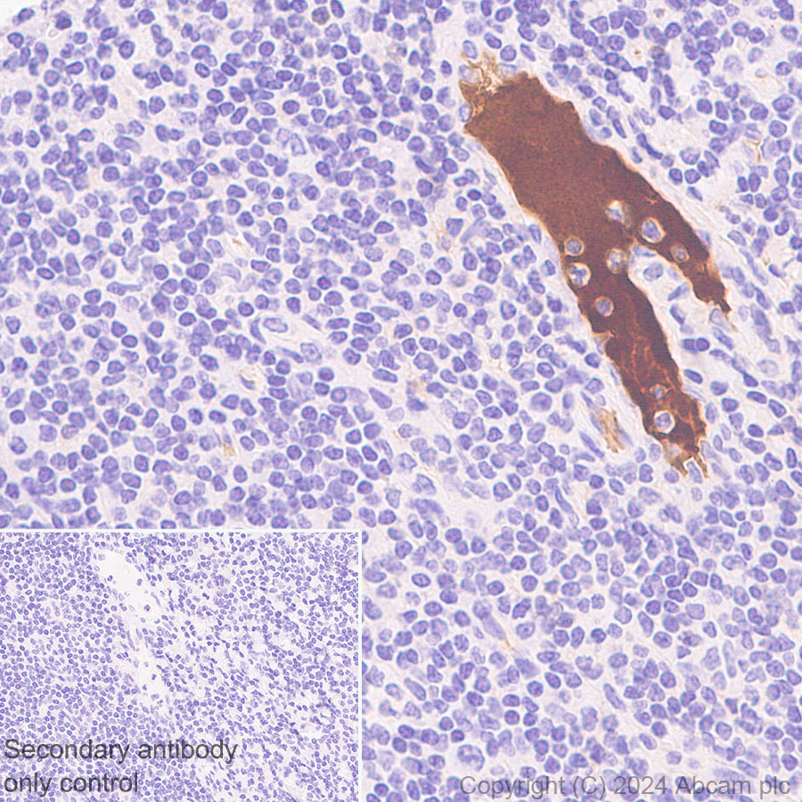 Immunohistochemistry (Formalin/PFA-fixed paraffin-embedded sections) - Anti-Albumin antibody [RM1208] (AB320751), expandable thumbnail
