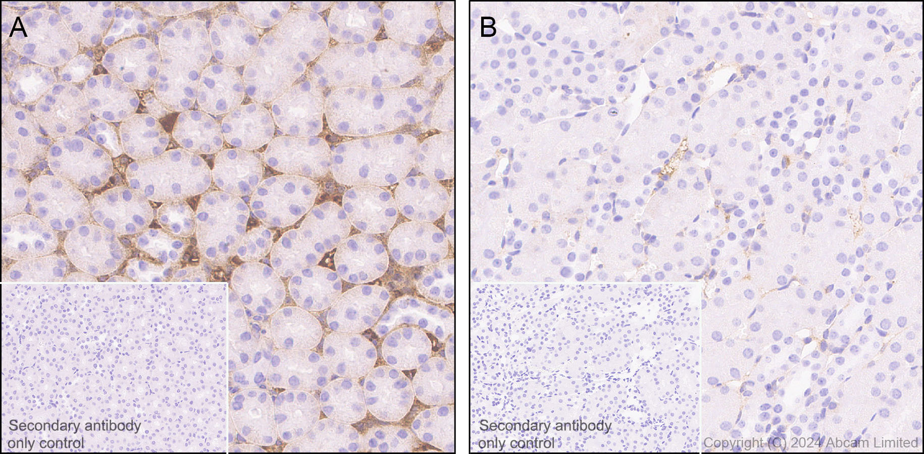Immunohistochemistry (Formalin/PFA-fixed paraffin-embedded sections) - Anti-Albumin antibody [RM1208] (AB320751), expandable thumbnail