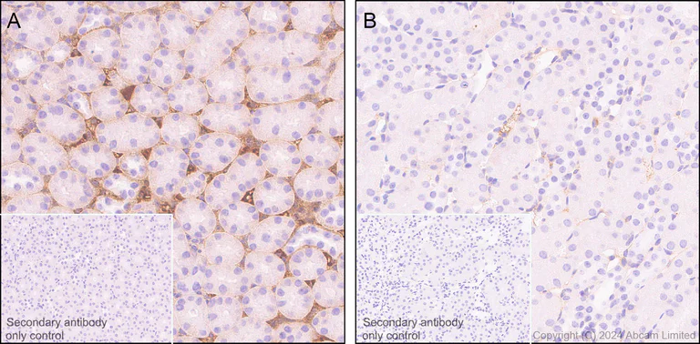 Immunohistochemistry (Formalin/PFA-fixed paraffin-embedded sections) - Anti-Albumin antibody [RM1208] (AB320751)