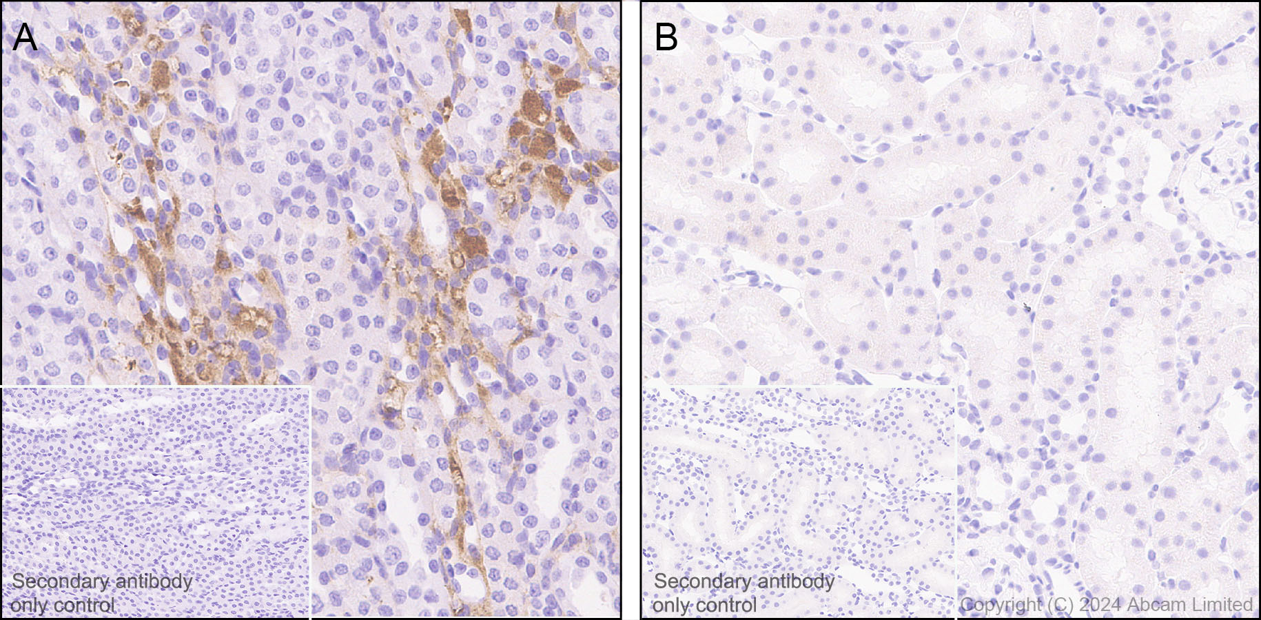 Immunohistochemistry (Formalin/PFA-fixed paraffin-embedded sections) - Anti-Albumin antibody [RM1208] (AB320751), expandable thumbnail
