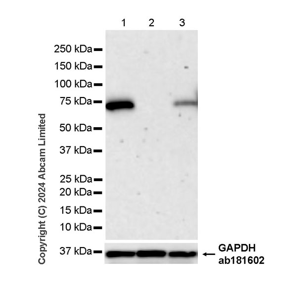 Western blot - Anti-Albumin antibody [RM1208] (ab320751), expandable thumbnail