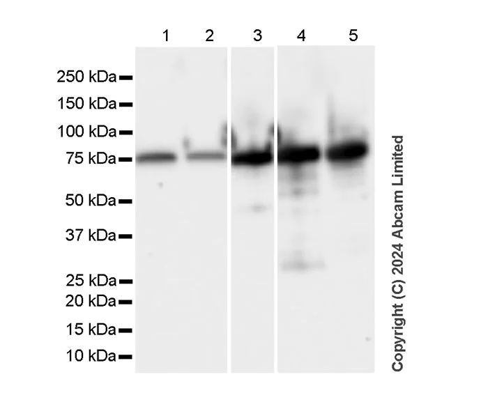 Western blot - Anti-Albumin antibody [RM1208] (AB320751)