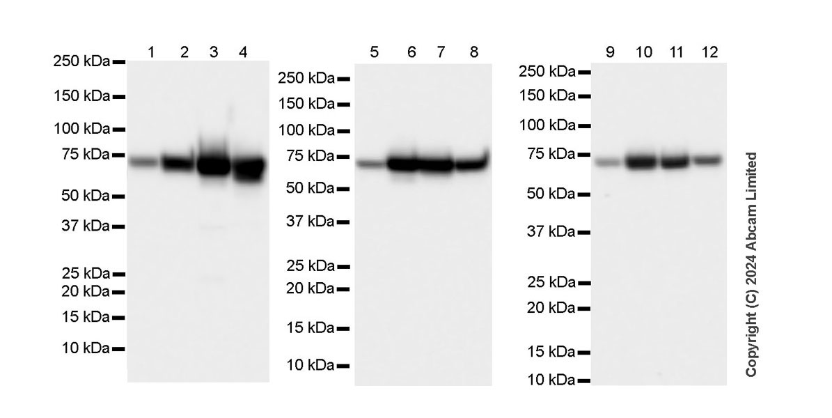 Western blot - Anti-Albumin antibody [RM1208] (ab320751), expandable thumbnail