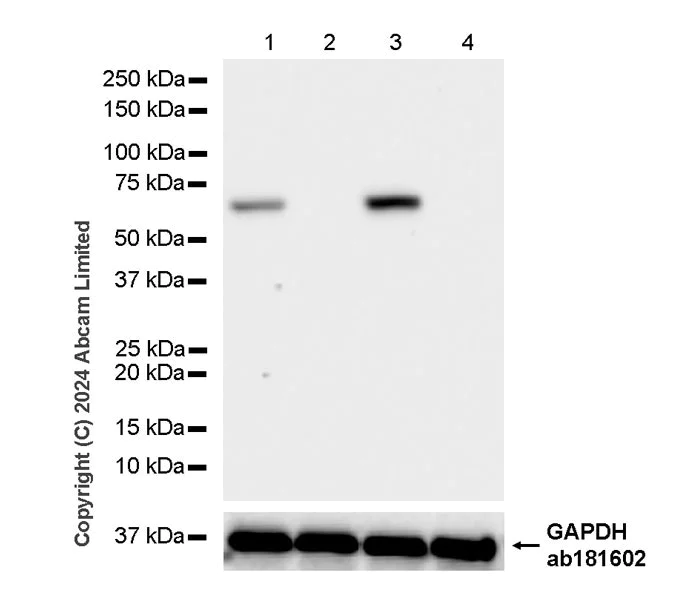 Western blot - Anti-Albumin antibody [RM1208] (AB320751)
