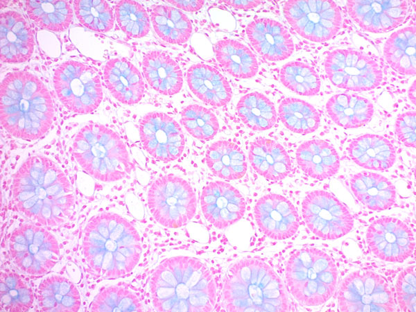 Immunohistochemistry (Formalin/PFA-fixed paraffin-embedded sections) - Alcian Blue Stain Kit (pH 1.0, Mucin Stain) (AB150661), expandable thumbnail