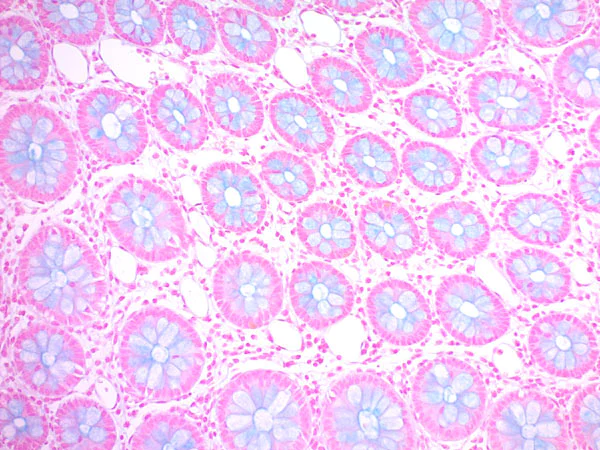 Immunohistochemistry (Formalin/PFA-fixed paraffin-embedded sections) - Alcian Blue Stain Kit (pH 1.0, Mucin Stain) (AB150661)