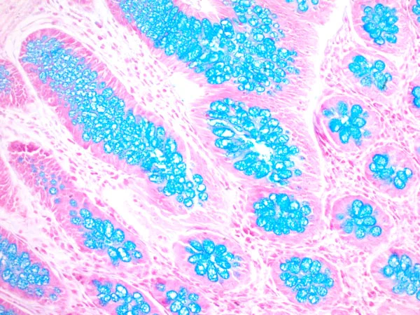Immunohistochemistry (Formalin/PFA-fixed paraffin-embedded sections) - Alcian Blue Stain Kit (pH 2.5, Mucin Stain) (AB150662)