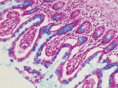 Immunohistochemistry (Formalin/PFA-fixed paraffin-embedded sections) - Alcian Blue Stain Kit (pH 2.5, Mucin Stain) (AB150662)