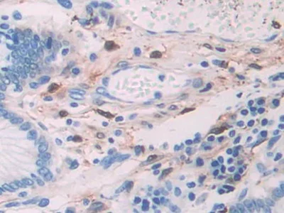 Immunohistochemistry (Formalin/PFA-fixed paraffin-embedded sections) - Anti-Alcohol Dehydrogenase antibody (AB231521)