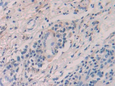 Immunohistochemistry (Formalin/PFA-fixed paraffin-embedded sections) - Anti-Alcohol Dehydrogenase antibody (AB231521)