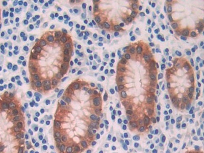 Immunohistochemistry (Formalin/PFA-fixed paraffin-embedded sections) - Anti-Alcohol Dehydrogenase antibody (AB231521)