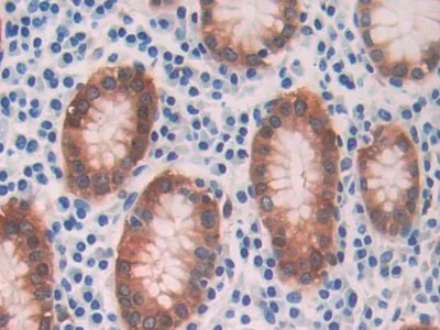 Immunohistochemistry (Formalin/PFA-fixed paraffin-embedded sections) - Anti-Alcohol Dehydrogenase antibody (AB231521)