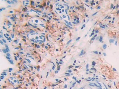 Immunohistochemistry (Formalin/PFA-fixed paraffin-embedded sections) - Anti-Alcohol Dehydrogenase antibody (AB231521)