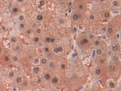Immunohistochemistry (Formalin/PFA-fixed paraffin-embedded sections) - Anti-Alcohol Dehydrogenase antibody (AB231521)