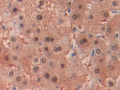 Immunohistochemistry (Formalin/PFA-fixed paraffin-embedded sections) - Anti-Alcohol Dehydrogenase antibody (AB231521)